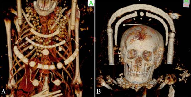 Las momias femeninas llevaban hermosos collares. Un volumen reconstruido que muestra los detalles de la momia del retrato femenino joven con cuentas alrededor del cuello, la región torácica y una horquilla en la parte superior de su cabeza. (Zesch S, et al. PLOS One / CC BY 4.0)