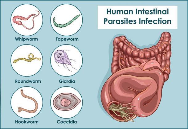 Estos son solo algunos de los gusanos parásitos y otras formas de vida que pueden vivir en nuestras bacterias intestinales y dañarnos, y esto fue así hace mil años y hoy. (corbacserdar / Adobe Stock)