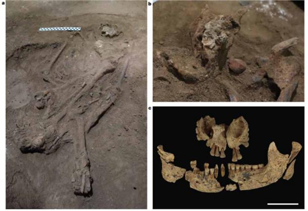 Características del entierro de Liang Tebo del amputado de 29000 a.C de Borneo, Indonesia: a) Inhumación de un solo adulto (TB1); el cráneo está a la derecha de la barra de escala; b) nódulo in situ de color rojo ocre (pigmento natural de la tierra) junto a la mandíbula; c) Maxilar y mandíbula. Barra de escala, 5 centímetros o 2 pulgadas. (Maloney, et al. / Nature)