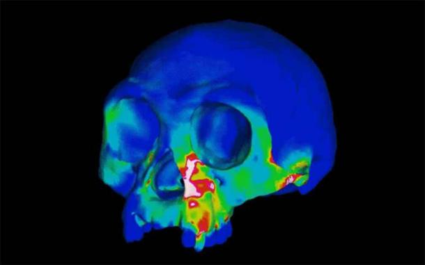 Captura de pantalla de una simulación por computadora del cráneo de Homo floresiensis (también conocido como el Hobbit) durante la mordedura. (Laboratorio Ledogar / Duke University)