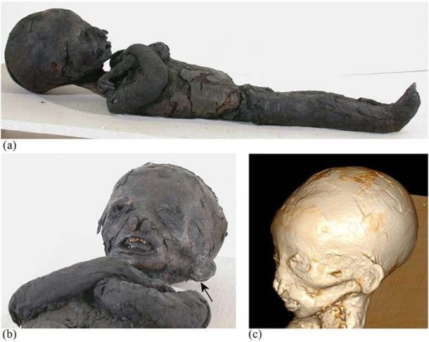 La tecnología de tomografía computarizada se utilizó en el estudio de las momias de niños del antiguo Egipto para estudiar la prevalencia de la anemia. (Panzer et al. / CC BY-NC-ND 4.0)