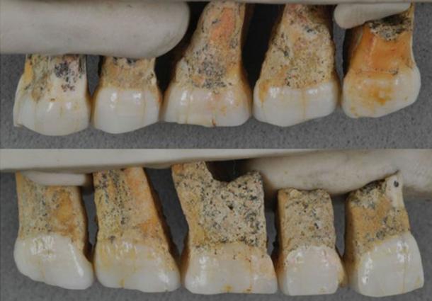 Dientes de Homo luzonensis encontrados - evidencia de la nueva especie humana. (Florent DÃ©troit / Â© Callao Cave Archeology Project)