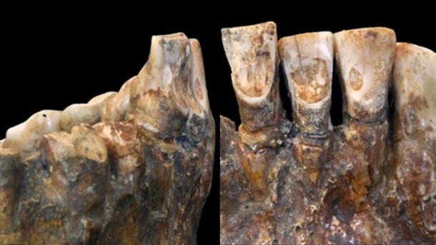 Willman dice que los restos de 12,000 años de antigüedad tienen un "patrón muy específico de desgaste dental" (American Journal of Physical Anthropology).